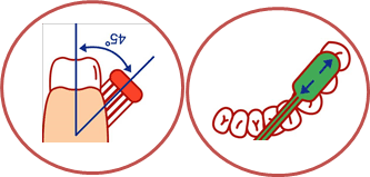 歯ブラシを当てるポイントの説明図