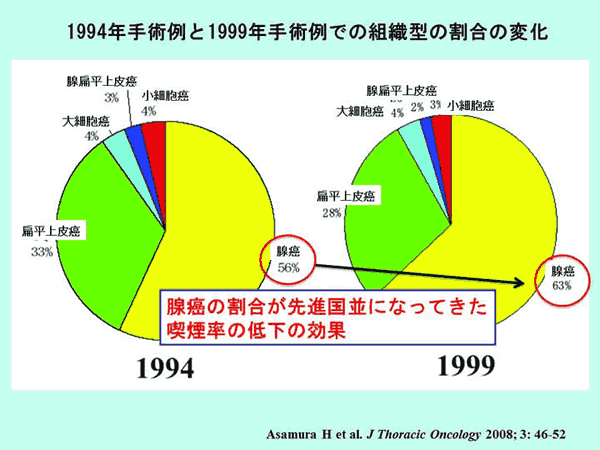 1994年手術例と1999年手術例での組織型の割合の変化